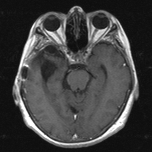 Captura de pantalla 2017-03-03 17.21.45