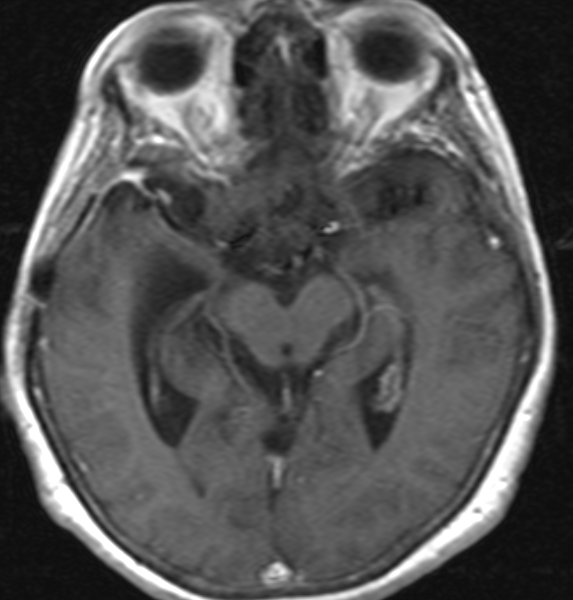 Captura de pantalla 2017-03-03 17.22.09