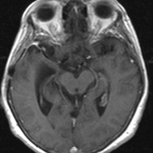 Captura de pantalla 2017-03-03 17.22.09