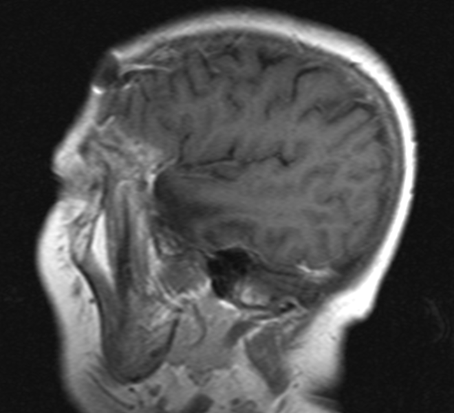 Captura de pantalla 2017-03-03 17.25.45