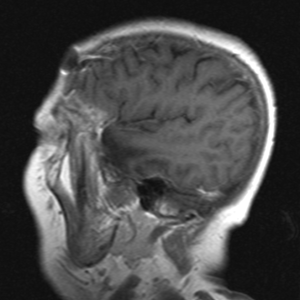 Captura de pantalla 2017-03-03 17.25.45